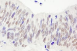 Nbs1 Antibody, Novus Biologicals 0.1mL; Unlabeled:Antibodies, Polyclonal